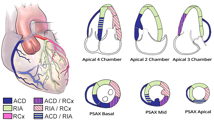 Coronary arteries blood supply and heart chambers