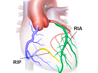 Ramus interventricularis posterior (left posterior descending artery), ramus interventricularis anterior (left anterior descending artery)