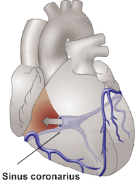 Coronary sinus (sinus coronarius) collet blood via veins from heart. Vena cordis magna, media, parva