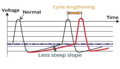 SA node depolarization cycle lengthening, if funny current