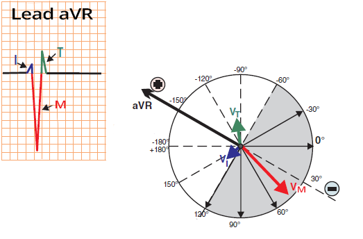 Heart axis determination in positive hemisphere of aVR limb lead
