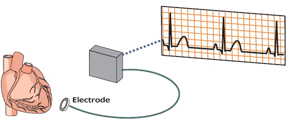 ECG electrode and calibration