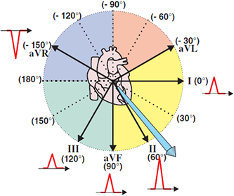 Electrical QRS axis in frontal plane with limb leads
