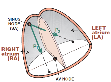 Schematic representation of the atria, P wave depolarization vectors