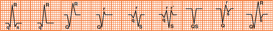 Q wave and QRS complex terminology, nomenclature