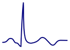 ECG biphasic negative T wave, terminal part of T wave is negative