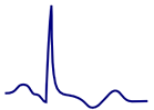 ECG biphasic positive T wave, terminal part of T wave is positive