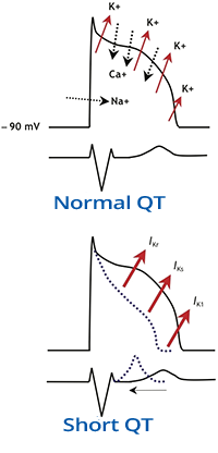 ECG normal QT, and short QT interval