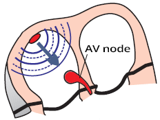 SA node, AV node depolarisation vectors