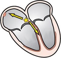 junctional rhythm