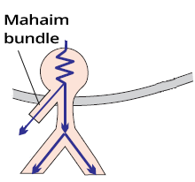 Mahaim fiber, Mahaim syndrome