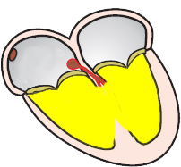 Heart complete ventricles depolarisation