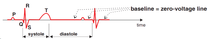 ECG of normal healthy, zero voltage line