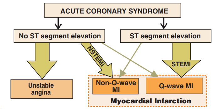 NSTEMI (Non-ST Elevation Myocardial Infarction) acute coronary syndrome, No ST segment elevation, Unstable angina, NSTEMI, Non-Q-wave MI, ST segment ST elevation, STEMI, Q-wave MI, Myocardial infarction