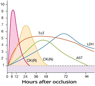 Cardiac infarction markers, Troponin (TnT), Creatine kinase (CK-MB), Lactate dehydrogenase (LDH), Aspartate transaminase (AST), Myoglobin