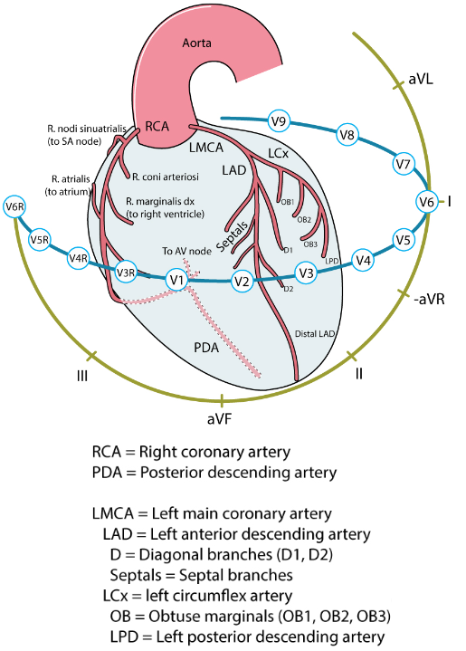 Localization myocardial infarction, 12 lead ECG, affected wall, culprit vessel