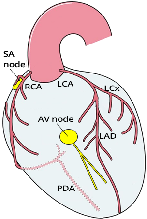 Schematic representation of conduction system and blood supply, Ischemia and infarction