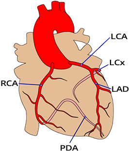 Three major coronary heart arteries: Left Anterior Descending (LAD), Circumflex (LCx), Right Coronary Artery (RCA)