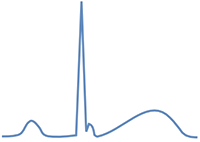 ECG benign early repolarization J wave or the new J point elevation without ST elevation