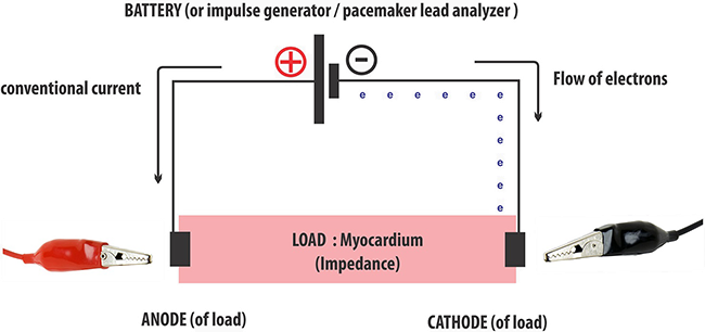 Pacemaker battery (impulse generator), conventional current, flow of electrons, anode, cathode, myocardium impedance
