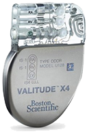 Cardiac Resynchronization Therapy - Pacemaker (CRT-P), biventricular pacemaker