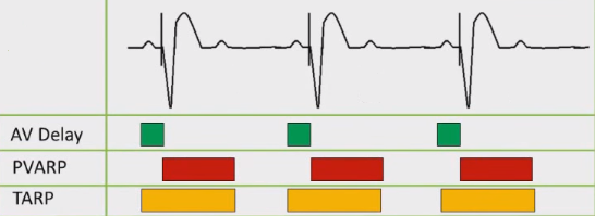 ECG pacemaker, TARP (Total atrial refractory period), TARP = AV interval (delay) + PVARP