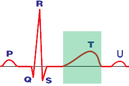ECG Electrical repolarization T wave alternans