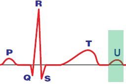 U wave electrical repolarization alternans