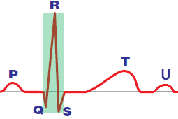 ECG Electrical QRS complex alternans
