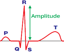 ECG waveform, amplitude