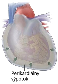 Cardiac motion electrical alternans