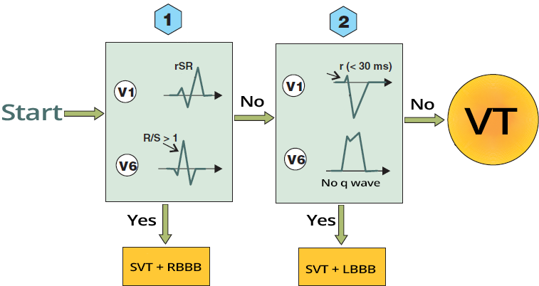Griffith (Bundle Branch Block) algorithm, SVT with RBBB morphology, SVT with LBBB morphology, ventricular tachycardia
