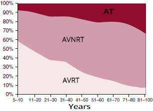 Paroxysmal SVT: AVNRT, AVRT, Atrial tachycardia
