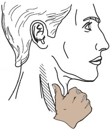 reentry tachycardia, carotid sinus massage