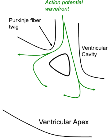 Normal physiology action potential wavefront, purkinje fiber twing