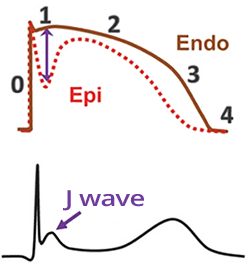 Action potential, phase 2 in endocardium and epicardium, J wave