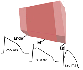 Transmural Action Potential Duration, Endocardium, M-myocardium, Epicardium