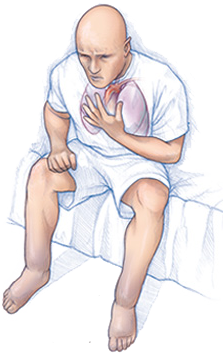 Congestive heart failure, coughing, swelling in ankles and legs
